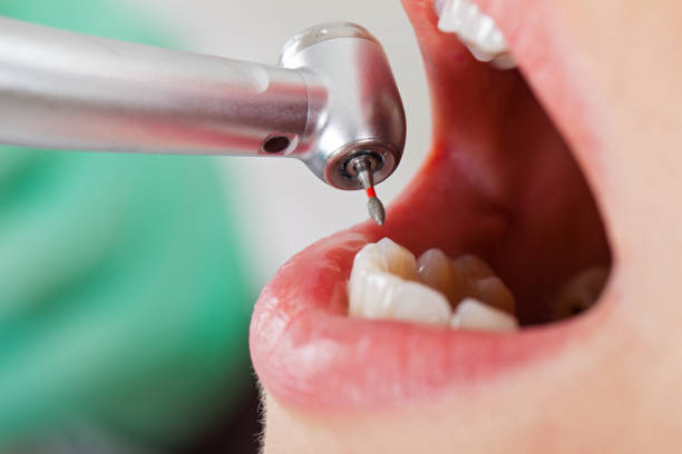 Best Pediatric Emergency Dentist in Fremont, OH